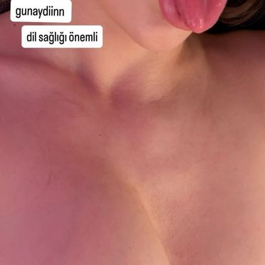 Liloya - Fotoğraf 2